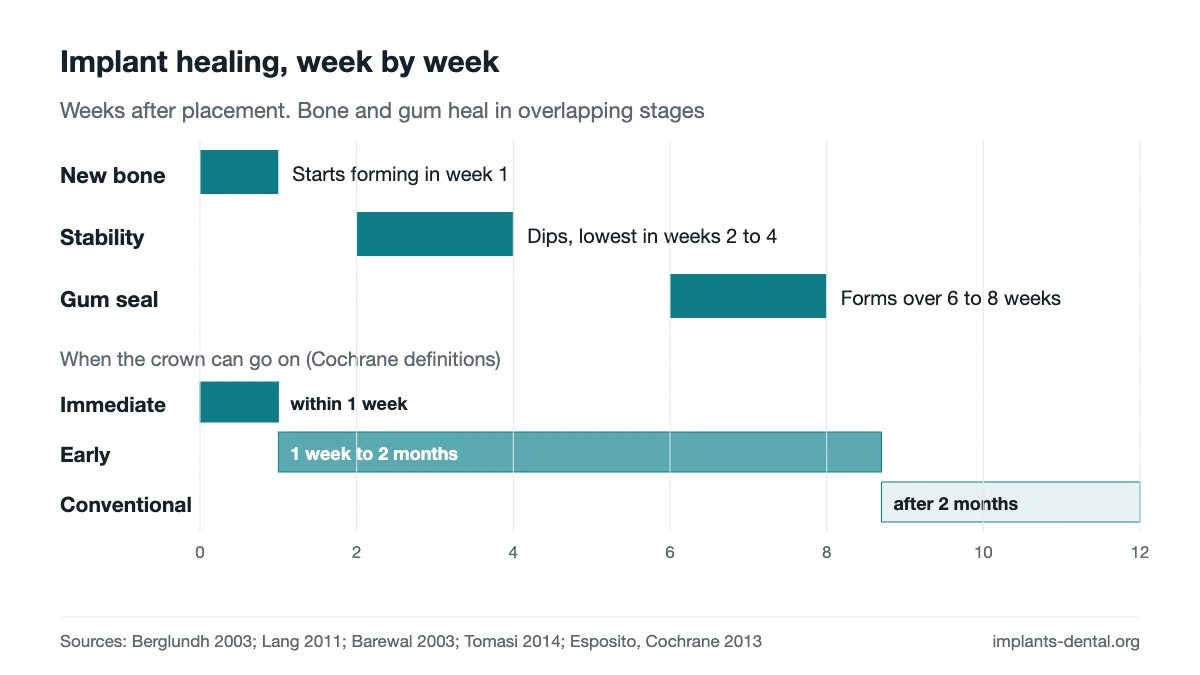 Timeline over 12 weeks: new bone starts in week 1, stability dips with its low point in weeks 2 to 4, the gum seal forms over 6 to 8 weeks, and the three loading windows for the crown